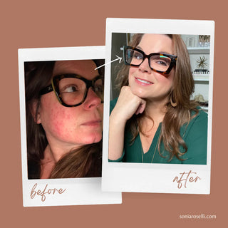 Before and After of Sonia Roselli