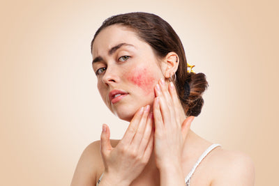 Causes and Best Tips on How to Reduce Facial Redness