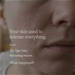 Close-up of a person's cheek and nose area with peeling skin and overlaid white text reading, 'Your skin used to tolerate everything. Now? Dry.