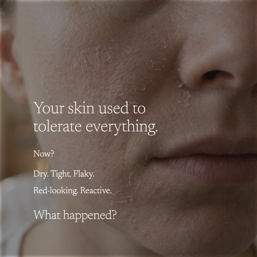 Close-up of a person's cheek and nose area with peeling skin and overlaid white text reading, 'Your skin used to tolerate everything. Now? Dry.