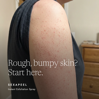 Close-up of a person's shoulder and upper arm showing red exfoliation bubbles from SEXAPEEL Instant Exfoliation Spray, with text overlay 'Rough, bumpy skin? Start here.' and product branding at the bottom.