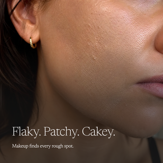 Close-up of a woman's cheek and ear showing textured, flaky skin, with white text reading 'Flaky. Patchy.