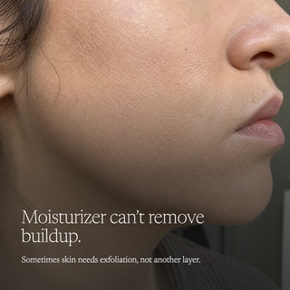 Close-up of a person's cheek and mouth area showing dry, flaky skin texture, with overlaid text reading 'Moisturizer can't remove buildup. Sometimes skin needs exfoliation, not another layer.