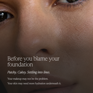 Close-up of a person's nose and eye area with overlaid text reading 'Before you blame your foundation Patchy. Cakey.