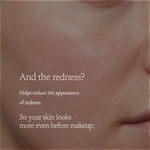Close-up of a person's cheek and mouth area with overlaid text reading, 'And the redness? Helps reduce the appearance of redness. So your skin looks more even before makeup.