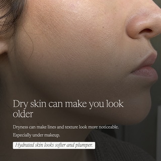 Close-up of a woman's lower face showing dry, textured skin with overlaid text about dry skin making you look older and suggesting hydrated skin looks softer and plumper.
