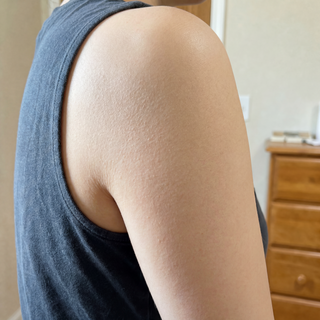 after strawberry skin image