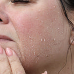 PHA-based gel texture for chemical exfoliation on sensitive skin without stinging.