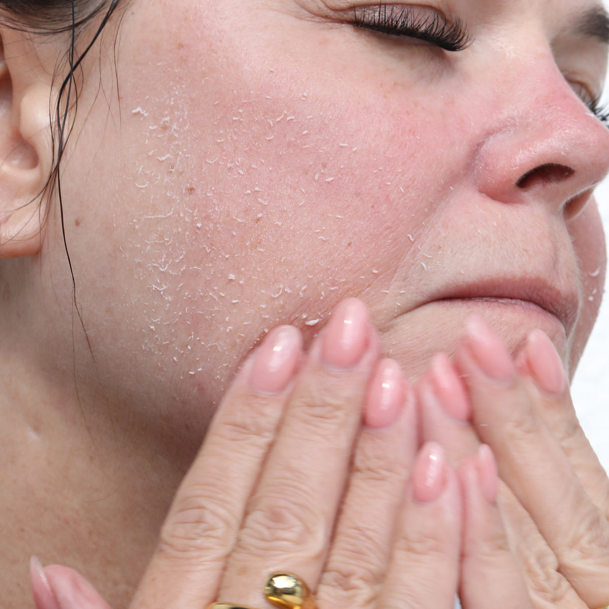 Gommage Peeling Gel gently rolling dead skin cells off sensitive skin during exfoliation — by Sonia Roselli Beauty
