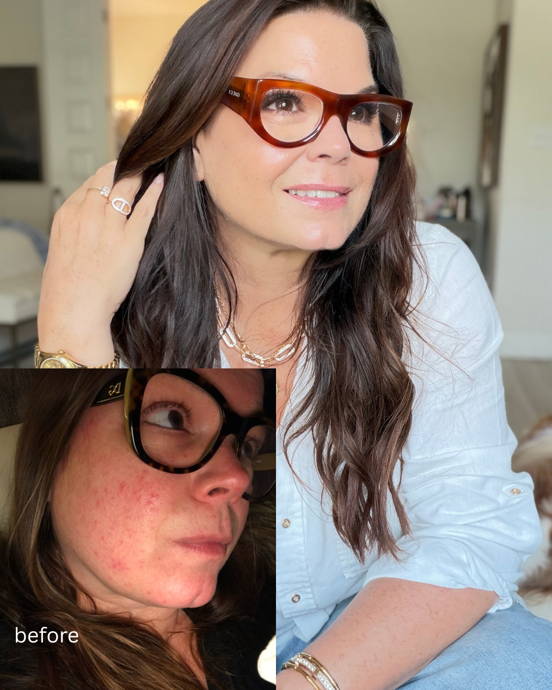 Woman wearing glasses with a close-up of her face labeled 'before' in a home setting. Eye cream made for sensitive eyes